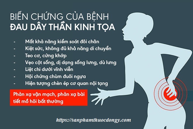 Biến chứng của bệnh đau thần kinh tọa