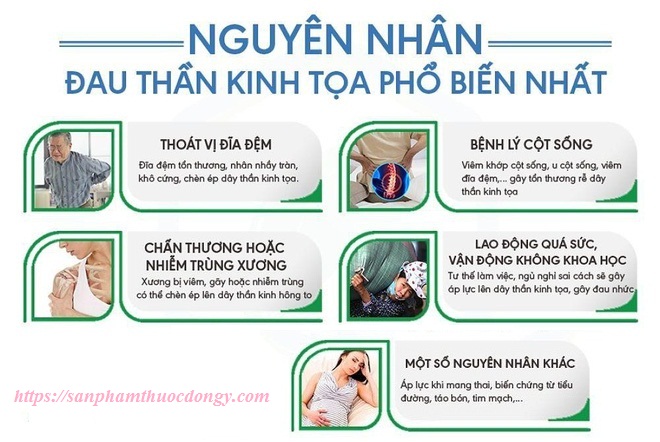 Nguyên nhân gây đau dây thần kinh tọa