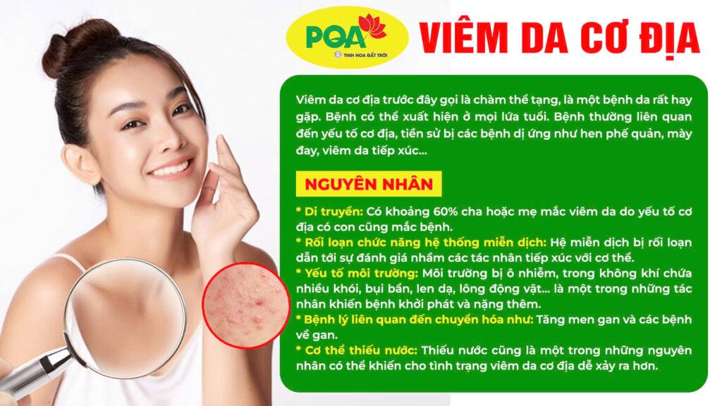 Nguyên nhân bệnh viên da cơ địa