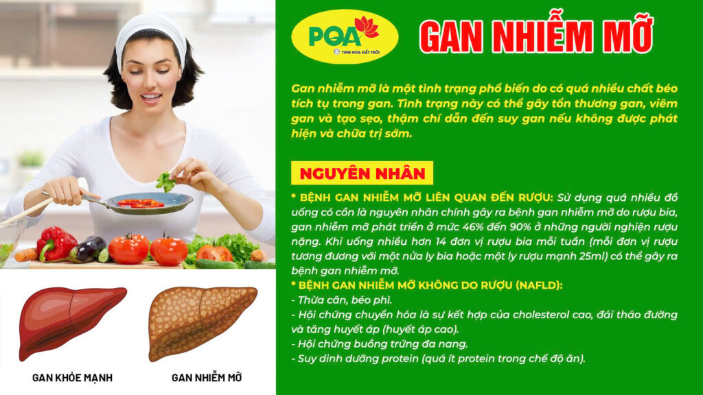 Nguyên nhân gan nhiễm mỡ